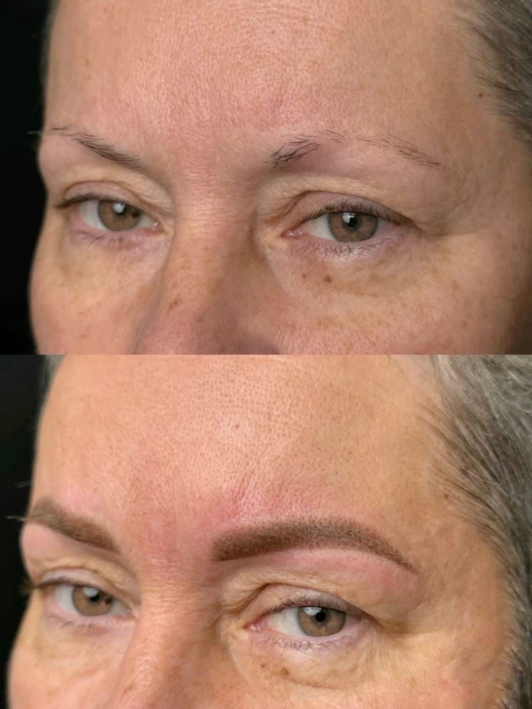 Sobrancelhas antes e depois, em vista frontal
